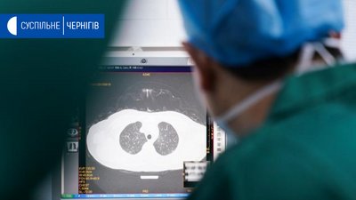 За добу на Чернігівщині від коронавірусу одужали 18 людей, 1 людина захворіла