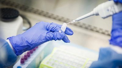 У Києві за добу виявили 125 хворих на COVID-19