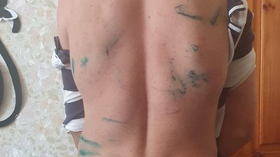 Рани змащені зеленкою: в інтернаті на Сумщині виявили побитого персоналом закладу хлопця Рани змащені зеленкою: в інтернаті на Сумщині виявили побитого персоналом закладу хлопця