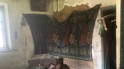 На Вінниччині внаслідок пожежі травмувалися дві людини На Вінниччині внаслідок пожежі травмувалися дві людини