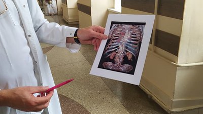 Усі внутрішні органи розташовані дзеркально. Львівські медики розповіли про нетипову операцію