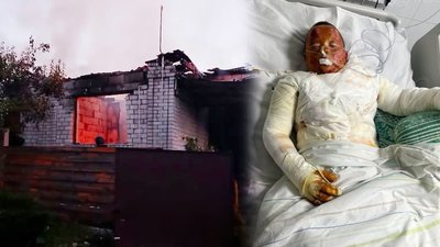 Поранена родина з трьома дітьми у Новгороді-Сіверському: який стан молодшого хлопчика