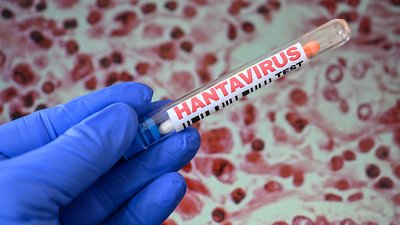 Хантавірус