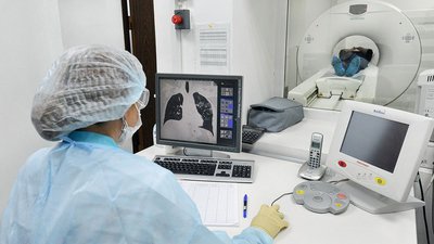 Комп’ютерна томографія – не панацея: кому і чому не варто робити КТ