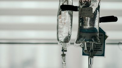 Вартість лікування хворих з інсультом з липня зросте до близько 27 тисяч