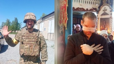 вторгнення, війна, ЗСУ. військовий, поранення, медицина, Коростень, Житомирщина