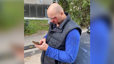 "Лінія вогню". Суспільне отримало відео бійки між ветераном АТО та вихідцями з Донецька в Києві "Лінія вогню". Суспільне отримало відео бійки між ветераном АТО та вихідцями з Донецька в Києві