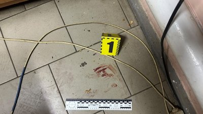 В Очакові чоловік ножем поранив незнайомця