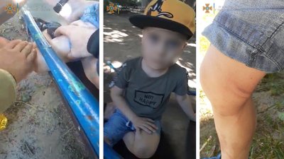 У Харкові хлопчик застряг на гірці — рятувальники звільняли олією