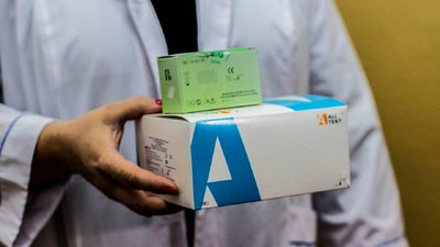 У Кіровоградській області пацієнтів із підозрою на коронавірус перевірятимуть у два етапи