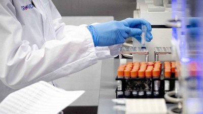 За добу коронавірус виявили у 492-х жителів області. Померли четверо людей, одужали 297