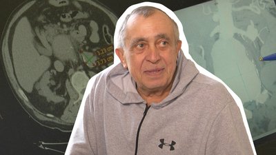 "В Україні таких випадків було 13": у Львові хірурги врятували чоловіка з розривом аневризми аорти