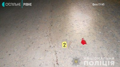На Рівненщині в ДТП травмувався мотоцикліст та його пасажир На Рівненщині в ДТП травмувався мотоцикліст та його пасажир