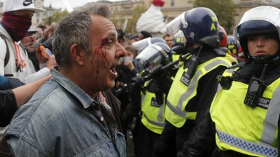 У Лондоні під час протестів проти карантину сталися сутички з поліцією У Лондоні під час протестів проти карантину сталися сутички з поліцією