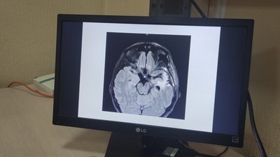 Перший огляд пацієнтки після операції з пробудженням провели в Ужгороді