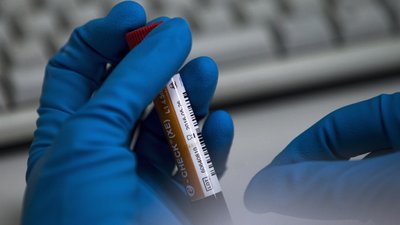 Спортсмени з Росії частіше за всіх порушували антидопінгові правила - WADA