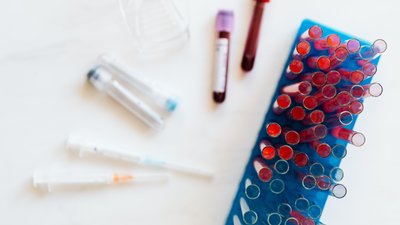 За добу коронавірус виявили у 22 жителів області, 35 хворих одужали