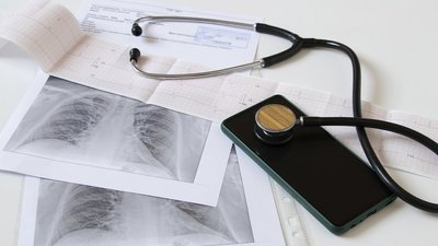 У Києві зростає кількість хворих на туберкульоз