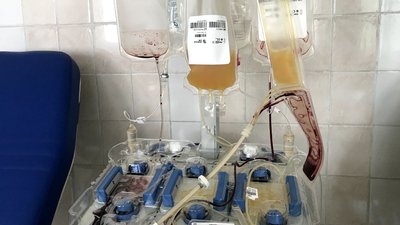 У Житомирському обласному центрі крові не вистачає тромбоцитів У Житомирському обласному центрі крові не вистачає тромбоцитів