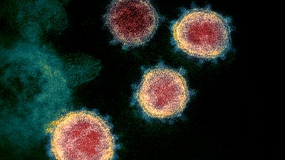 Від чого ще окрім коронавірусу можна втратити нюх Від чого ще окрім коронавірусу можна втратити нюх