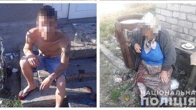 На Одещині травмувалося 5 людей в результаті вибуху На Одещині травмувалося 5 людей в результаті вибуху