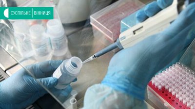 18 випадків COVID-19 виявлено на Вінниччині за добу, 1 пацієнт одужав