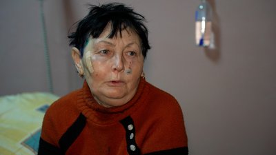 Поранена внаслідок обстрілу міста Гірник, Донецька область Поранена внаслідок обстрілу міста Гірник, Донецька область