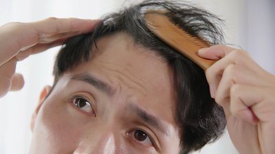 Випадіння волосся: яка норма, причини, хвороби та догляд. Розповідає дерматолог-трихолог Випадіння волосся: яка норма, причини, хвороби та догляд. Розповідає дерматолог-трихолог
