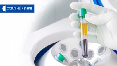 За минулу добу на Чернігівщині + 34 хворих, які інфікувалися Covid-19