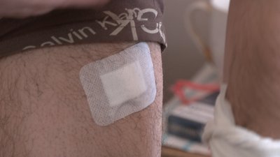 Уламкові поранення кінцівок та контузії: на Дніпропетровщині лікують двох бійців ЗСУ Уламкові поранення кінцівок та контузії: на Дніпропетровщині лікують двох бійців ЗСУ