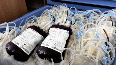 Тернопільський центр крові, кров, донор, працюватиме у суботу, 2 березня 2026, Тернопіль