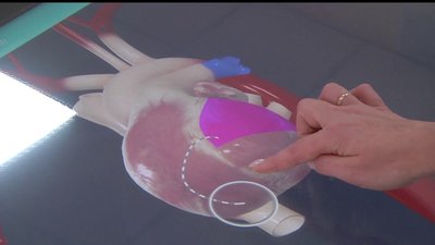 У лабораторії херсонського вишу з'явився анатомічний 3D-стіл. СУСПІЛЬНЕ | ВІДЕОНОВИНИ