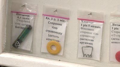 "Хочуть спробувати на зуб": лікар-ендоскопіст з Рівного показав, що найчастіше ковтають діти "Хочуть спробувати на зуб": лікар-ендоскопіст з Рівного показав, що найчастіше ковтають діти