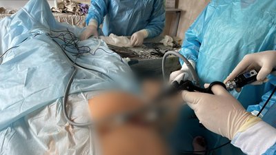 У Житомирському обласному онкодиспансері вперше провели операцію з видалення простати лапароскопічним методом У Житомирському обласному онкодиспансері вперше провели операцію з видалення простати лапароскопічним методом