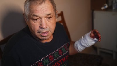 поранений склом після авіаудару