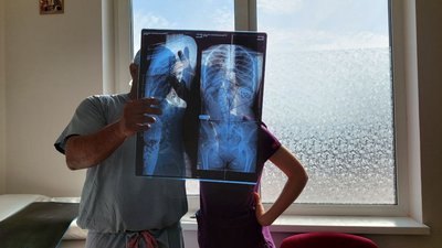 Медики оглядають рентген-знімки Медики оглядають рентген-знімки