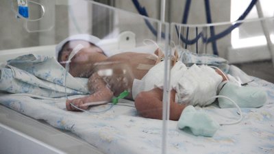 "Важко дивитися, коли задихається вагітна". Як працює ковідне відділення перинатального центру Одеси