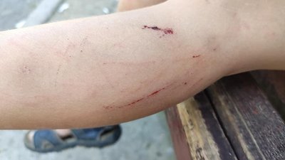 Дитина провалилася в яму в Ужгороді
