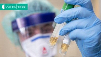 22 випадки за добу: ситуація на Вінниччині з COVID-19