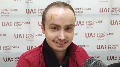 "Орфанні синиці Миколаївщини" об’єднують людей з рідкісними захворюваннями "Орфанні синиці Миколаївщини" об’єднують людей з рідкісними захворюваннями