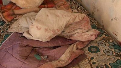 Бійка між сусідами в Черкасах: що її спровокувало та чи буде покарано нападника Бійка між сусідами в Черкасах: що її спровокувало та чи буде покарано нападника