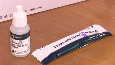 У Сумах почали робити експрес-тести на антиген до COVID-19