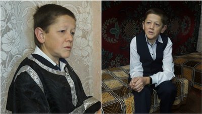 Любить вирощувати квіти та фотографувати: чоловік через хворобу має зовнішність підлітка