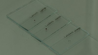 На Тернопільщині до 20% кліщів заражені бореліями: що робити, коли вкусив кліщ