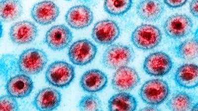 Всесвітній день боротьби зі СНІДом: як тестування і терапія рятують життя на Миколаївщині Всесвітній день боротьби зі СНІДом: як тестування і терапія рятують життя на Миколаївщині