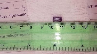 У Херсоні із пневматичної зброї невідомий поранив 17-річного хлопця У Херсоні із пневматичної зброї невідомий поранив 17-річного хлопця