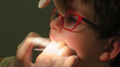 Діти з Приютівки зможуть лікуватись у стоматолога за гроші громади