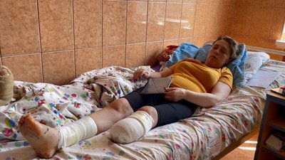 Мама і донька, які втратили ноги через обстріл вокзалу у Краматорську, готуються до протезування