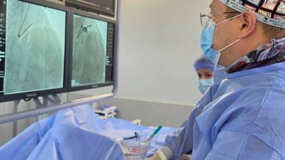операція, лікарня, орбітальна атеректомія, коронарні судини