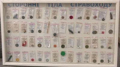 "Хочуть спробувати на зуб": лікар-ендоскопіст з Рівного показав, що найчастіше ковтають діти "Хочуть спробувати на зуб": лікар-ендоскопіст з Рівного показав, що найчастіше ковтають діти